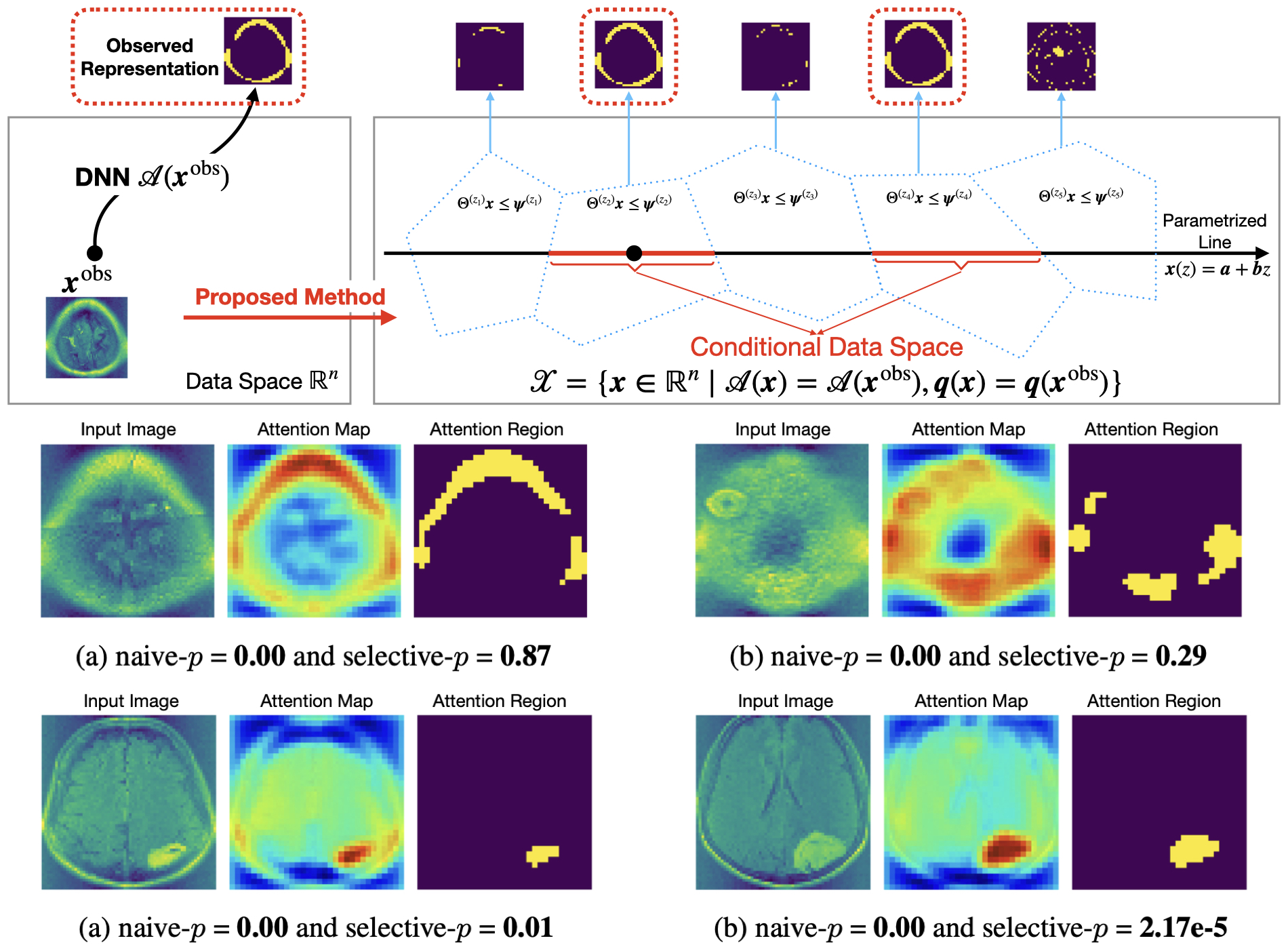 DNN Representation Selective Inference